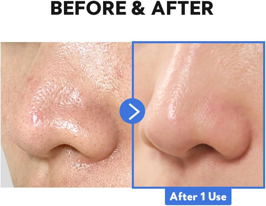 Hydro Boost Enzyme Cleansing Balm - 120ml-TIRTIR-Noura Skincare