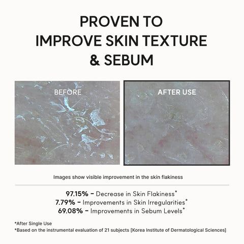 Eraser Shot Glycolic Acid Exfoliator Toner - 200ml