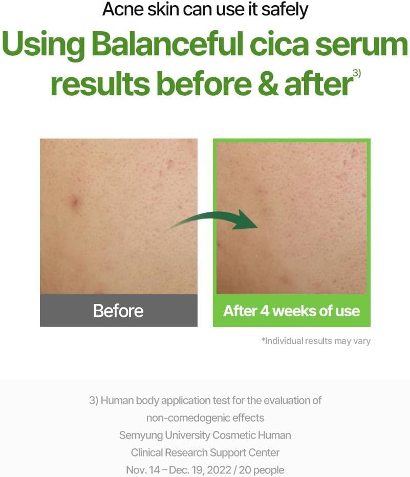 BALANCEFUL Serum - 50ml