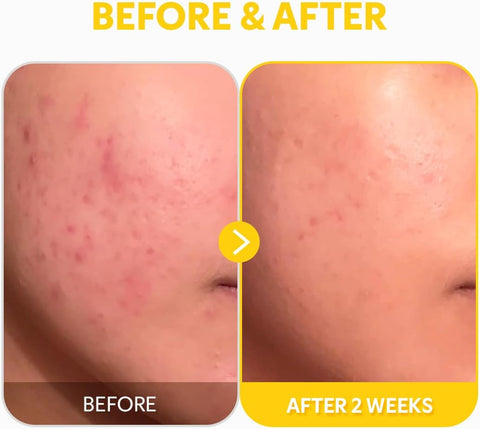 Pure Vitamin C 24% Serum - 30ml