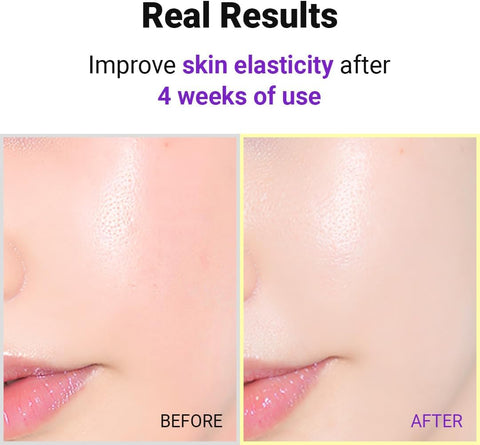 Hyper Retinol EX 1.0 Serum - 20ml