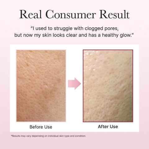 Fresh Rosehip Mochi Cleanser - 120g