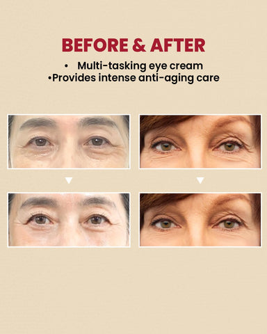 SEOUL 1988 Eye Cream: Retinal Liposome 4% + Fermented Bean - 30ml