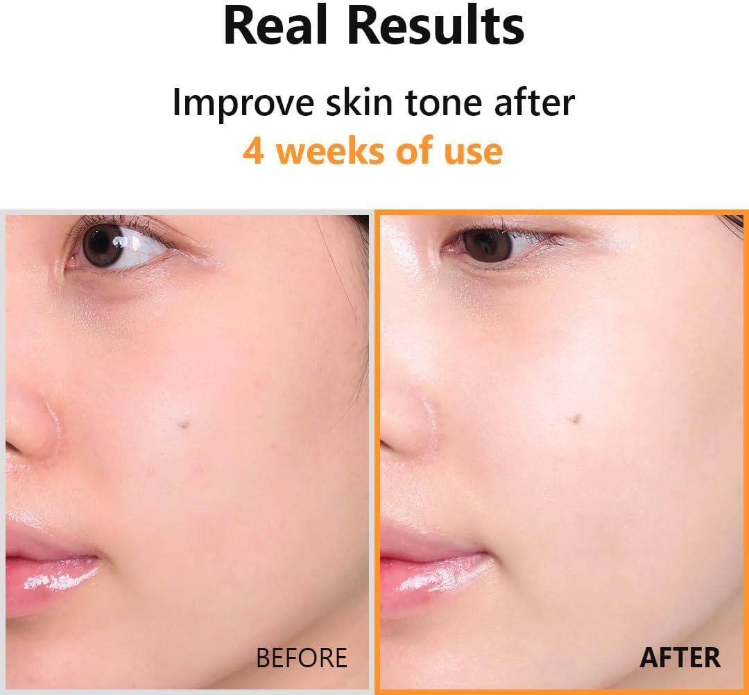 Hyper Vitamin C 23 Serum - 20ml