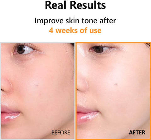 Hyper Vitamin C 23 Serum - 20ml