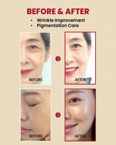 SEOUL 1988 Serum: Retinal Liposome 2% + Black Ginseng - 30ml