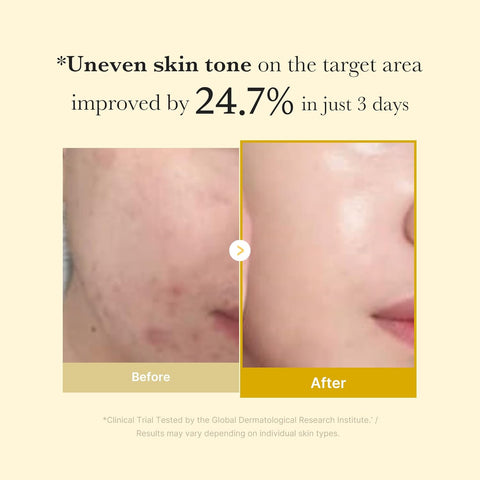 Kojic Acid Turmeric Night Wrapping Mask - 75ml