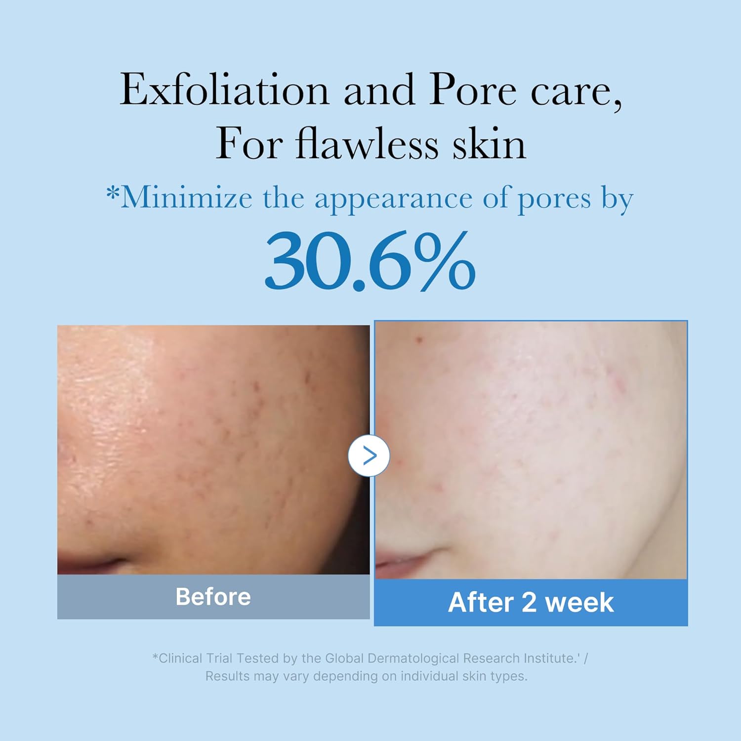 Zero Pore Toner - 250ml