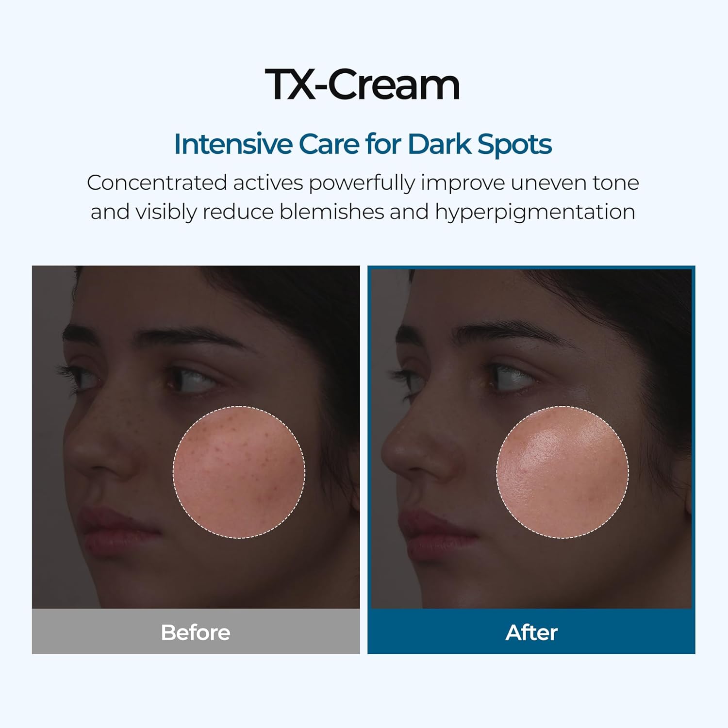 TX Cream - 50ml