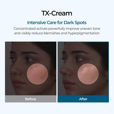 TX Cream - 50ml