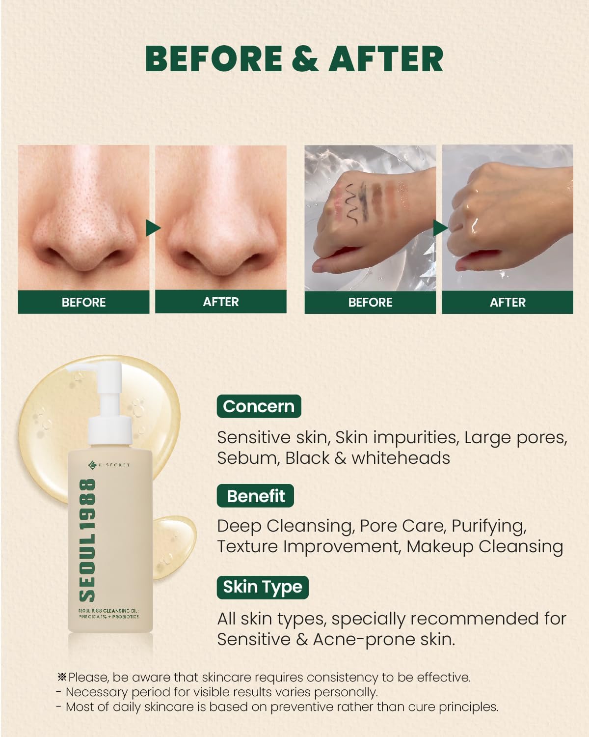SEOUL 1988 Cleansing Oil: Pine Cica 1% + Probiotics