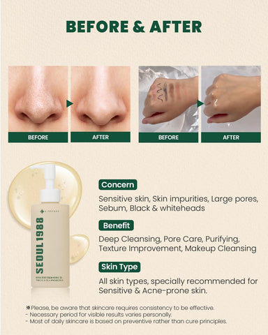SEOUL 1988 Cleansing Oil: Pine Cica 1% + Probiotics