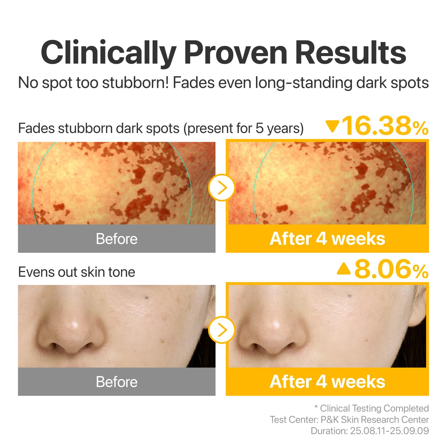 No.5 Glutathione TXA Advanced Dark Spot Ampoule Concentrate - 10g