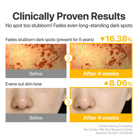 No.5 Glutathione TXA Advanced Dark Spot Ampoule Concentrate - 10g