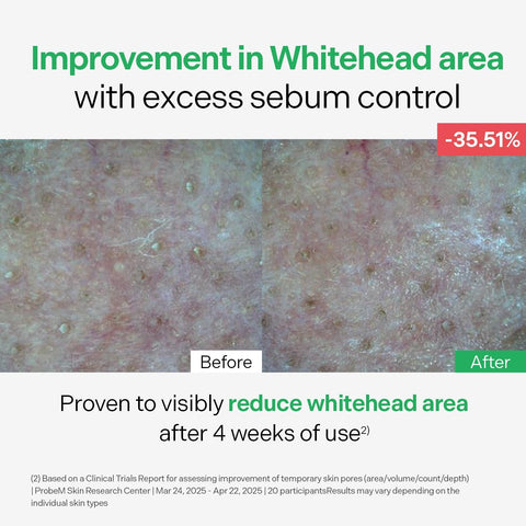 BALANCEFUL Control Serum - 50ml