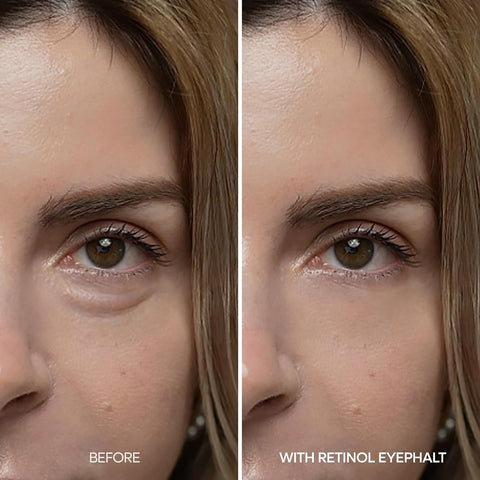 Retinol Eyebag Cream - 10g