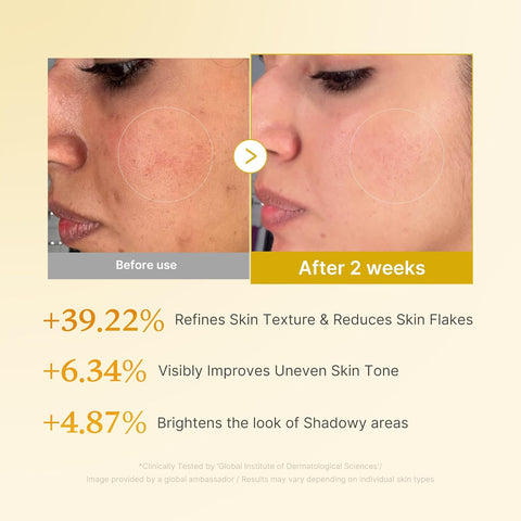 Kojic Acid Turmeric Resurfacing Toner - 250ml