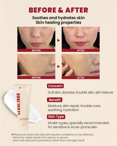 SEOUL 1988 Cream: Snail Mucin 93% + Rice - 100ml