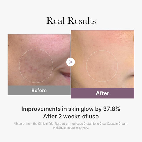 AGE-R Glutathione Glow Capsule Cream - 50ml