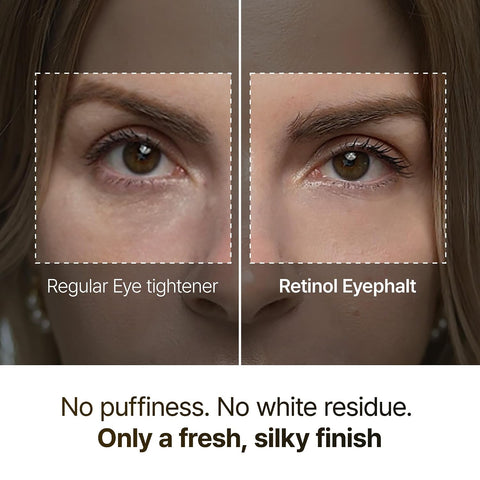 Retinol Eyebag Cream - 10g