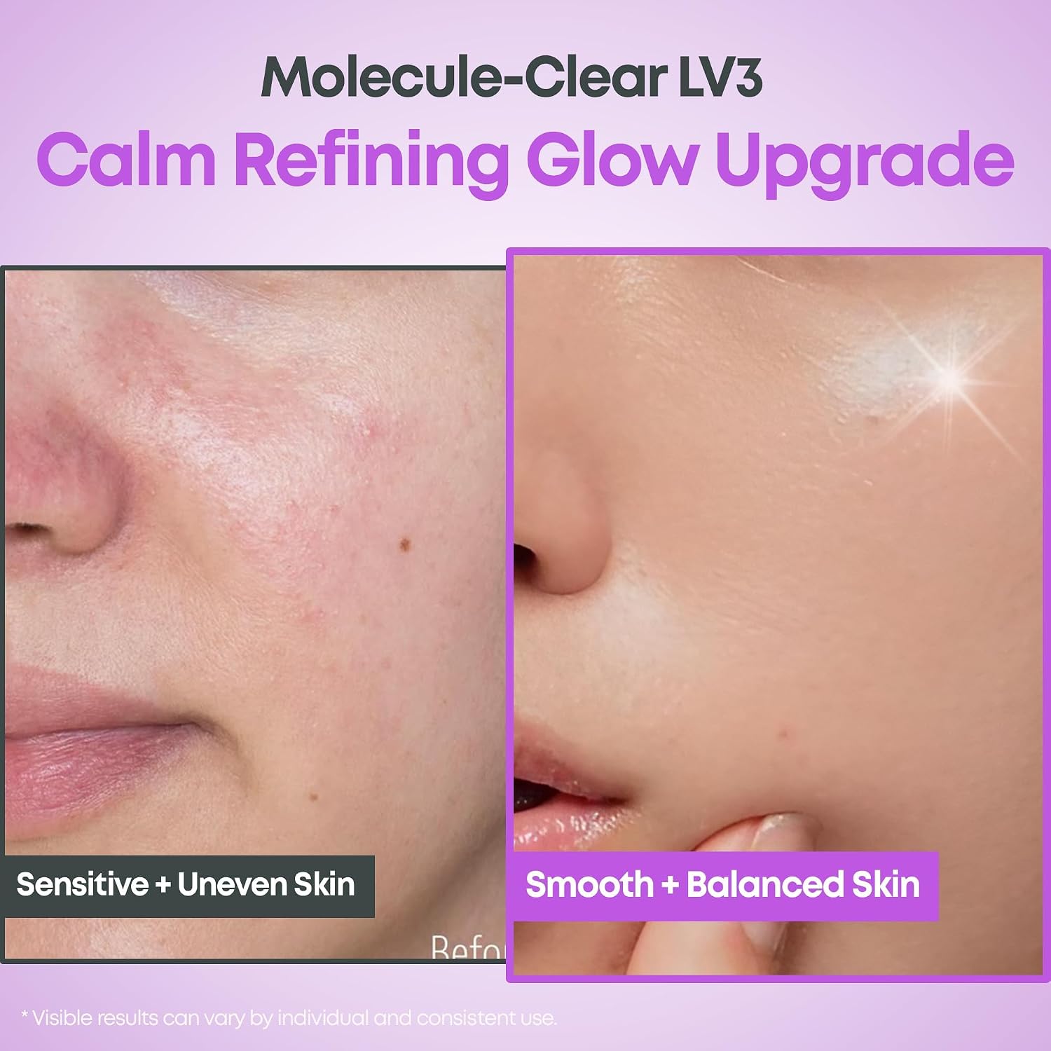 Molecule-Clear 5% Mandelic Acid Serum - 30ml