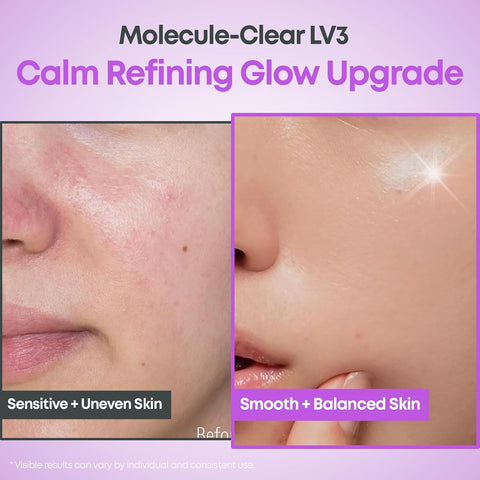 Molecule-Clear 5% Mandelic Acid Serum - 30ml
