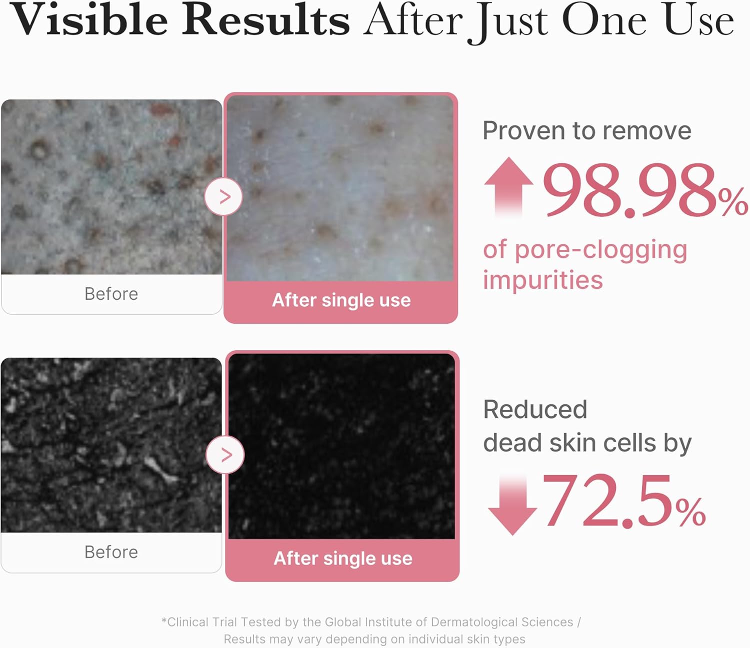 PDRN Pink Niacinamide Whip Cleanser - 120g-Medicube-Noura Skincare