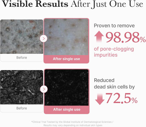 PDRN Pink Niacinamide Whip Cleanser - 120g-Medicube-Noura Skincare