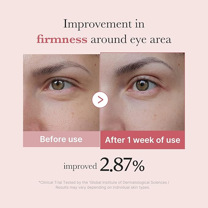 PDRN Pink Peptide Eye Cream - 30ml