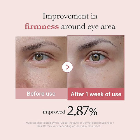 PDRN Pink Peptide Eye Cream - 30ml