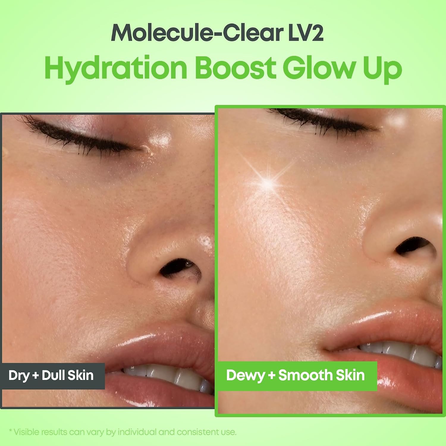 Molecule-Clear 5% Lactic Acid Serum - 30ml