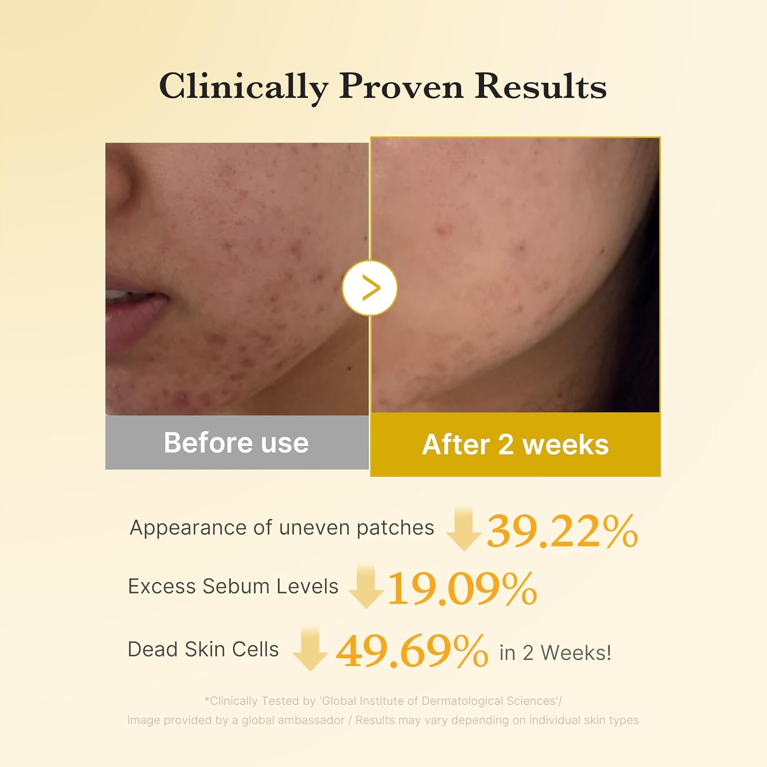 Kojic Acid Turmeric Resurfacing Toner - 160ml