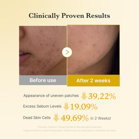 Kojic Acid Turmeric Resurfacing Toner - 160ml