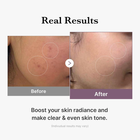 AGE-R Glutathione Glow Toner - 140 ml