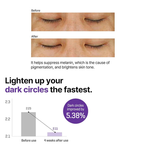 Retinol Intense Advanced Triple Action Eye Cream - 30ml