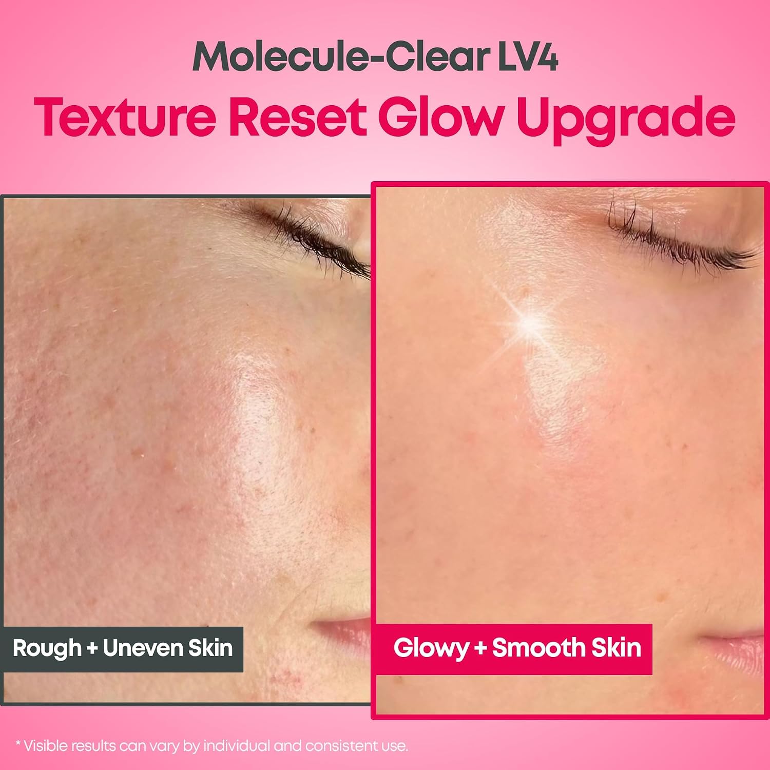 Molecule-Clear 5% Glycolic Acid Serum - 30ml