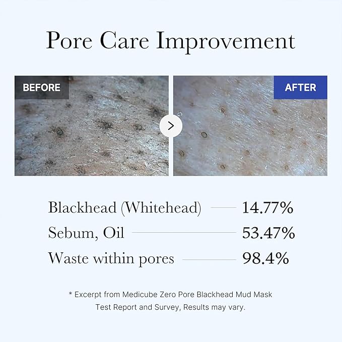 Zero Pore Blackhead Mud Mask - 100g