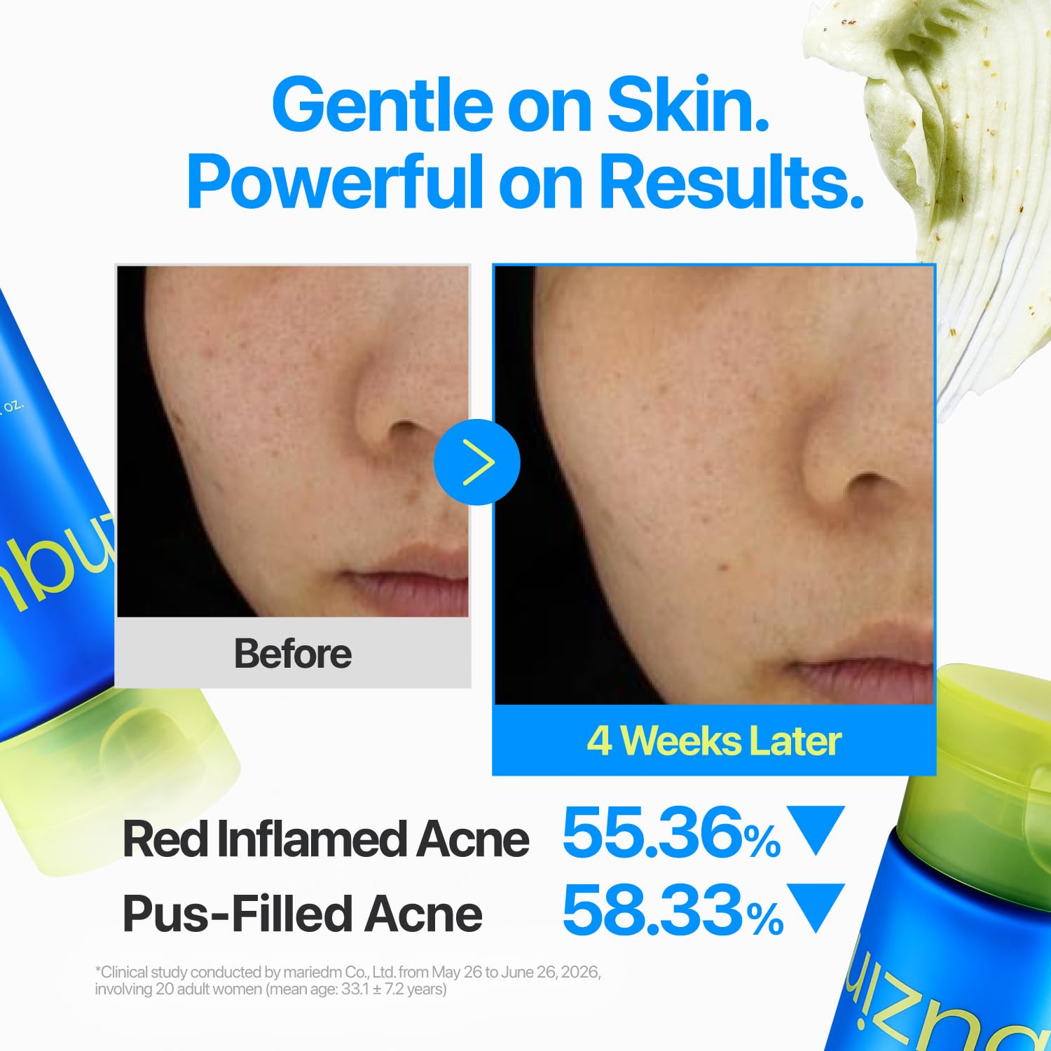 Zero Blemish Clarifying 2% Sulfur Cleansing Foam - 150ml