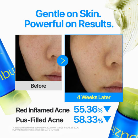 Zero Blemish Clarifying 2% Sulfur Cleansing Foam - 150ml