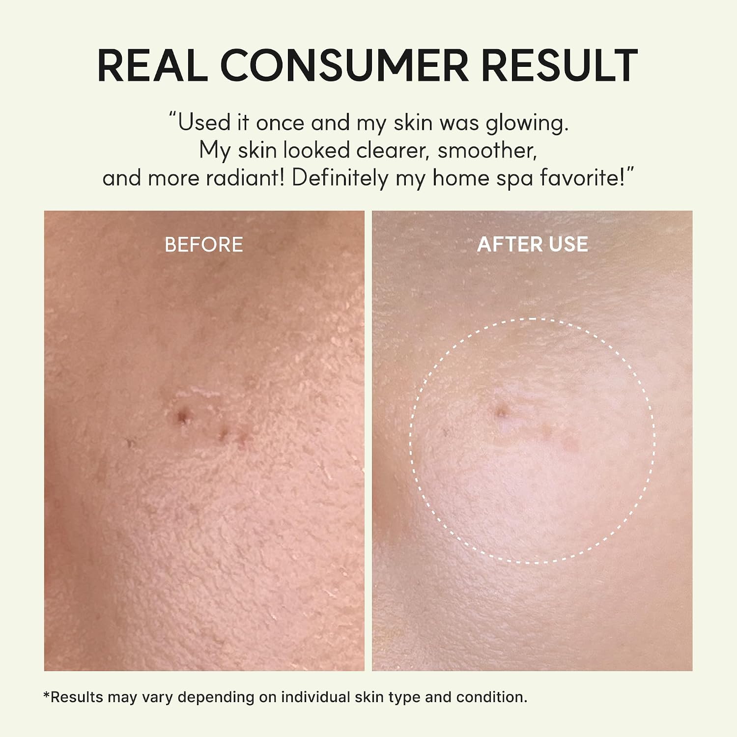 Vita Collagen Radiance Jello Mask - 4 Sheets