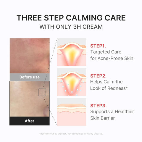 3H Relief Cream - 50ml
