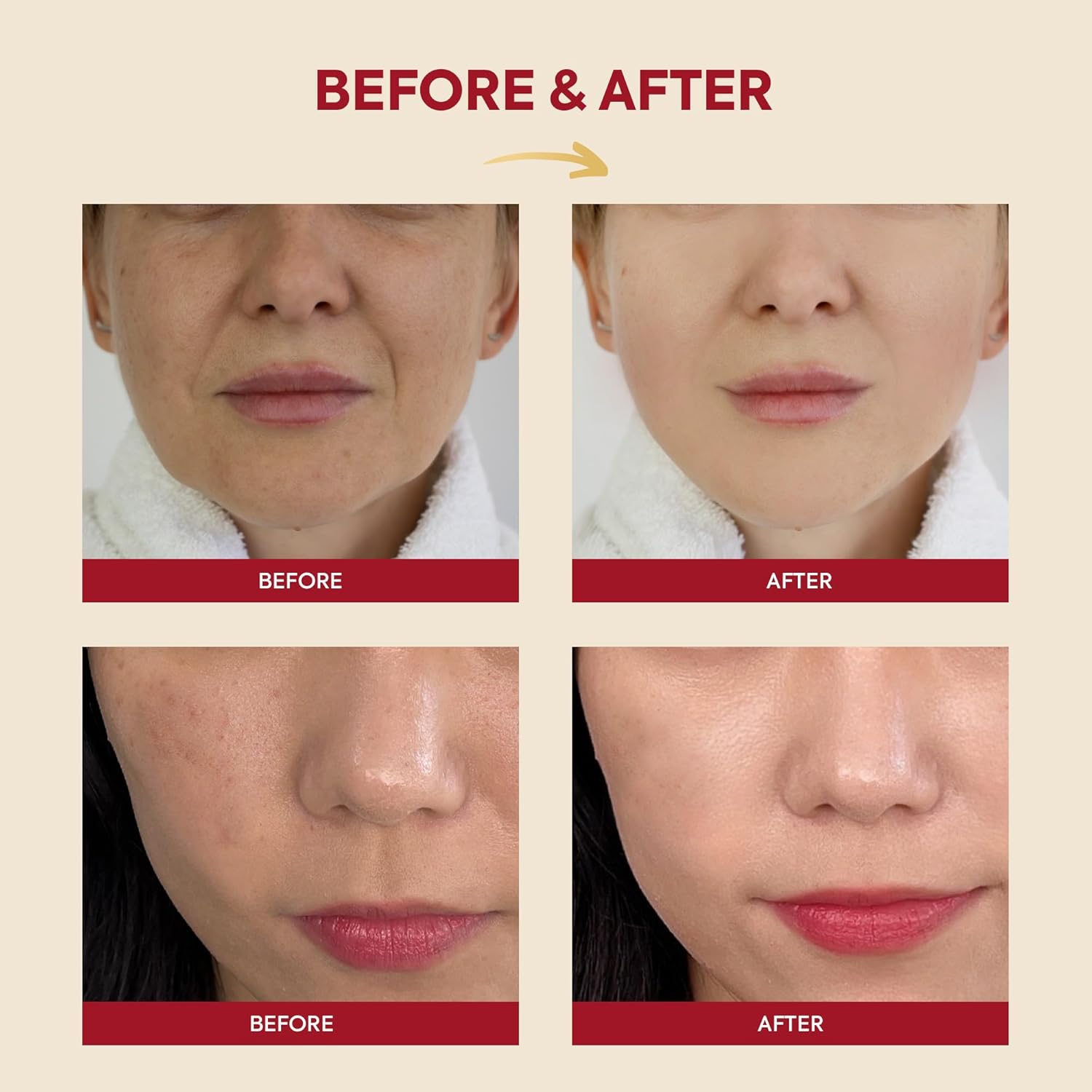 SEOUL 1988 Essence: Snail Mucin 97% + Rice