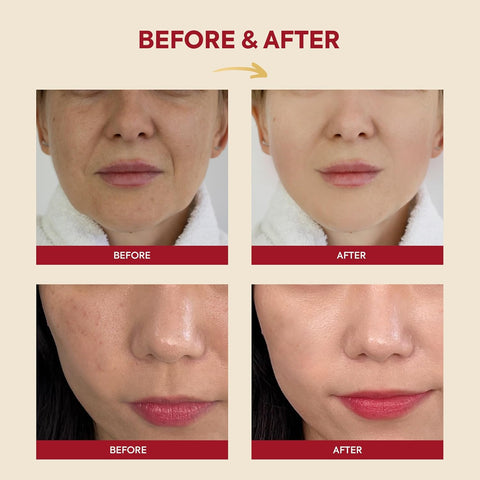SEOUL 1988 Essence: Snail Mucin 97% + Rice