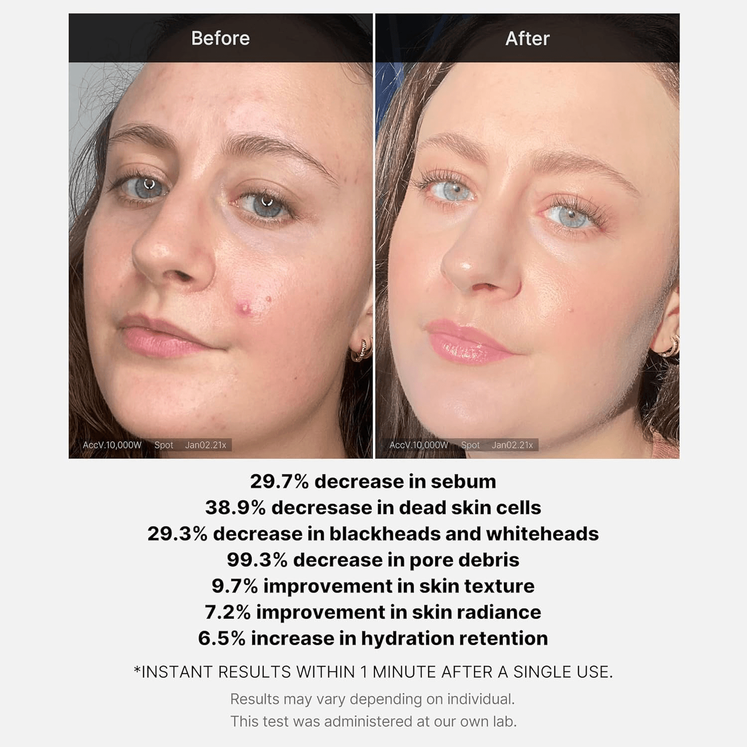 Red Succinic Acid Serum - 30ml