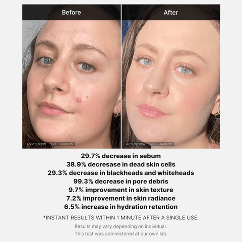 Red Succinic Acid Serum - 30ml
