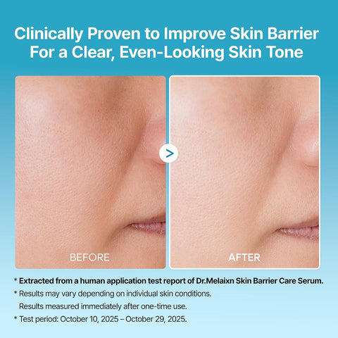 Exfoliating TX-Serum - 80ml