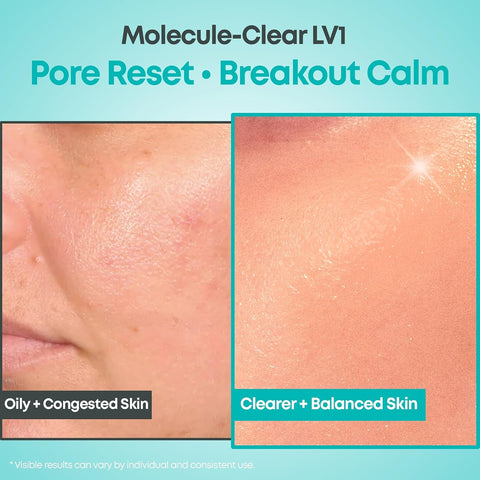 Molecule-Clear Salicylic Acid Serum - 30ml
