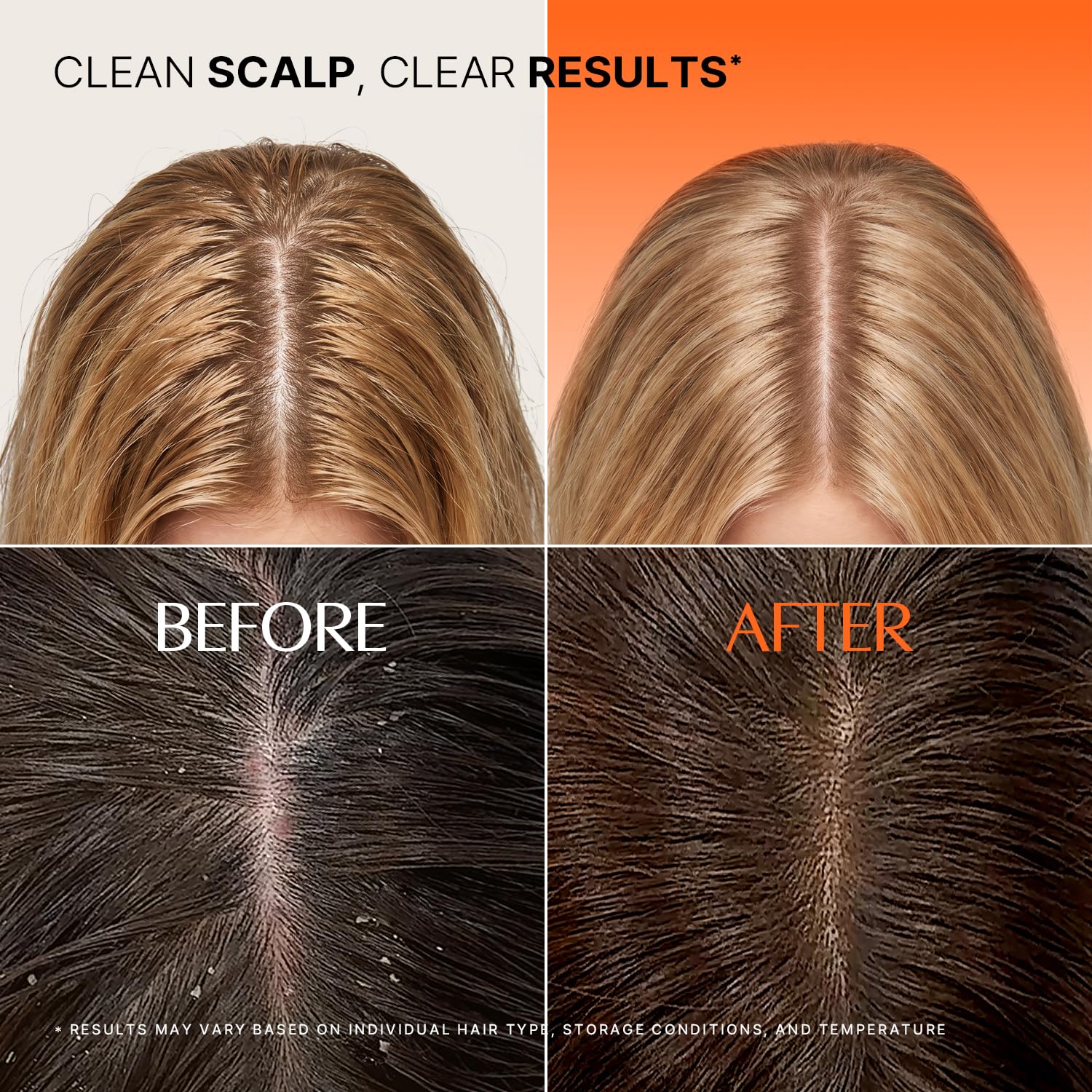 Exosome Scalp Cleansing Toner Pad - 15 Pads / 55ml