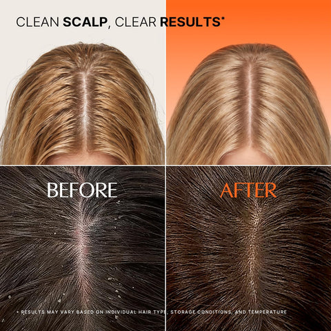Exosome Scalp Cleansing Toner Pad - 15 Pads / 55ml