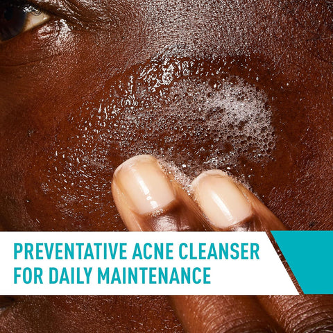 Acne Control Cleanser - 237ml
